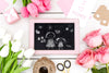Happy Mother'S Day With Blackboard Drawing And Flowers Psd
